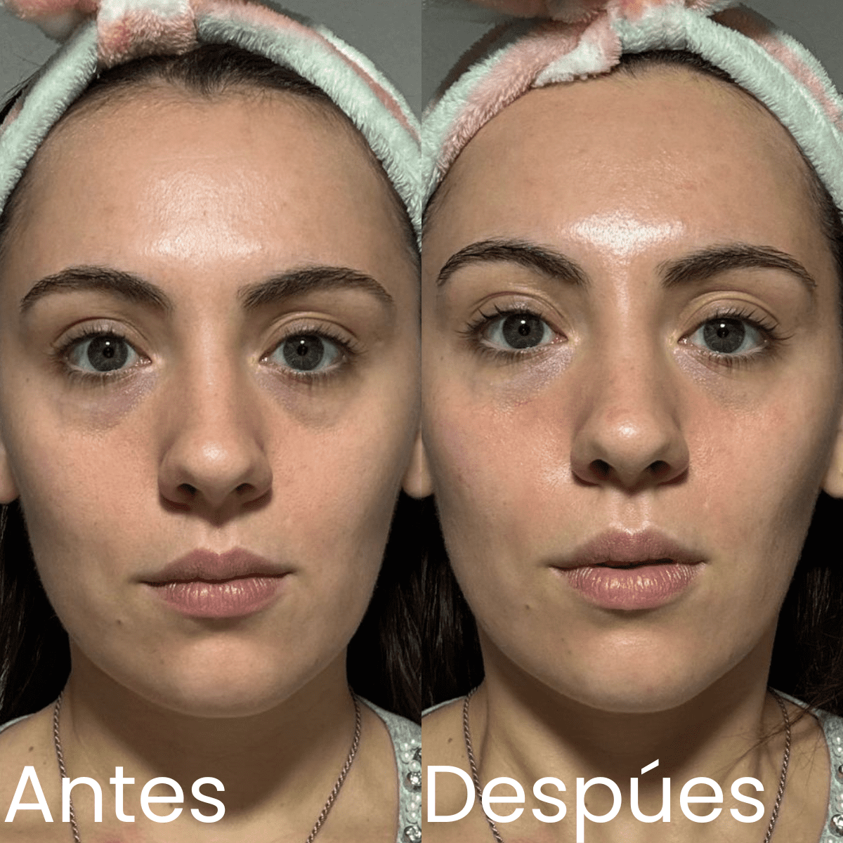 Antes y Despues
